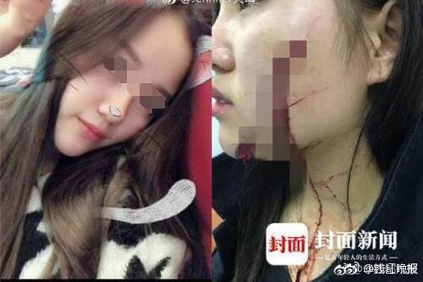 部落幸存者亚麻和芦苇有什么用